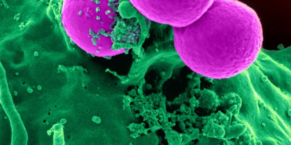 white-blood-cell-cell-blood-cell-blood-45239.jpeg white-blood-cell-cell-blood-cell-blood-45239.jpeg